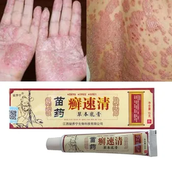 Dermatitis Oinment Luskavica Eczematoid Ekcem Mazilo za Nego Telesa Kitajski Krema za Zdravje Zeliščni Kože G7K5